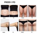 Maszyna Do Modelowania Sylwetki Ujędrnienie Lifting Budowanie Mięśni Redukcja Tłuszczu